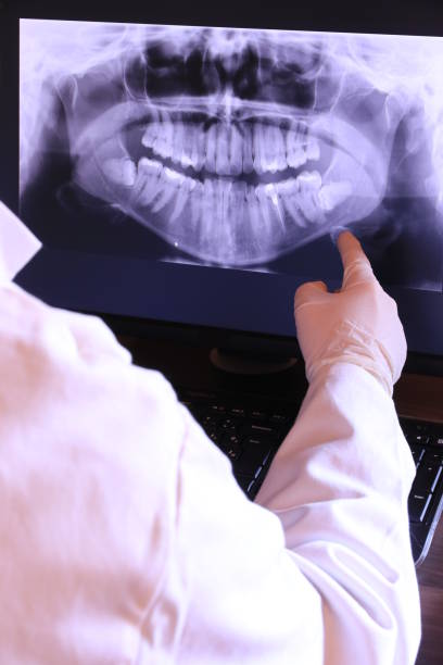 Best Emergency Dental Extractions in Azle, TX